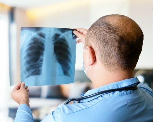 Car Accidents Can Result In A Potentially Deadly Pulmonary Embolism